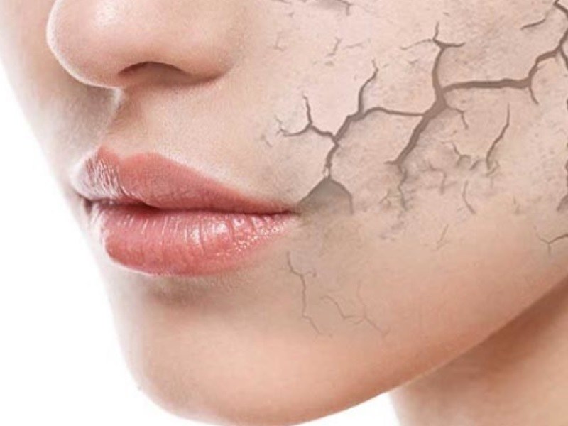 Skin condition scaly facial skin